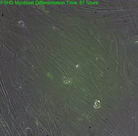 DUX4-Activated ntGFP Reporter Expression